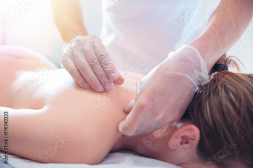 Physiotherapist doing acupuncture to a young woman on her back