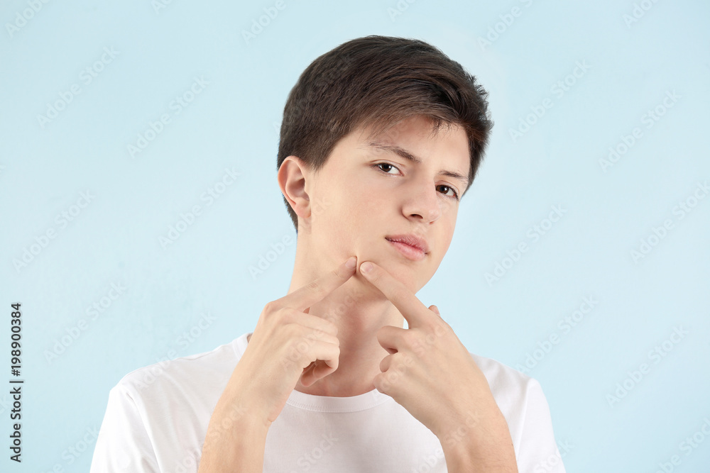 Teenage boy with acne problem on light background Teenage boy with acne problem on light background