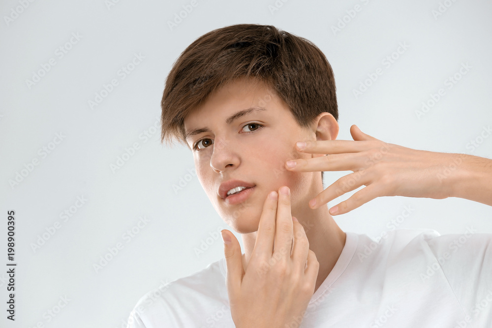 Teenage boy with acne problem on light background Teenage boy with acne problem on light background
