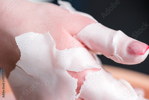 Quadro em tela Process paraffin treatment of female hands in beauty salon