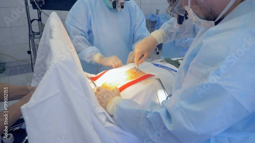 A surgeon is dissecting human chest during an operation photo