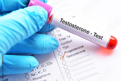 Blood sample for testosterone hormone test