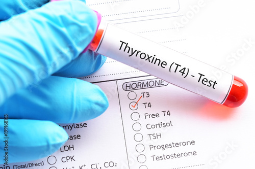 Blood sample for thyroxine (T4) hormone test photo