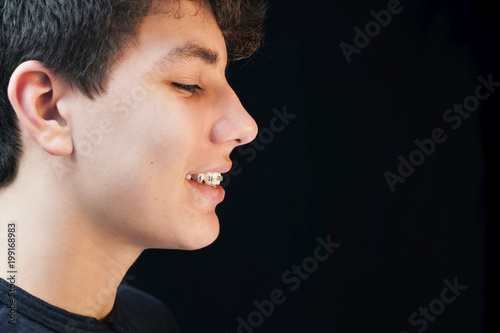 Portrait of a boy in a profile on a black background. Braces are installed on his teeth