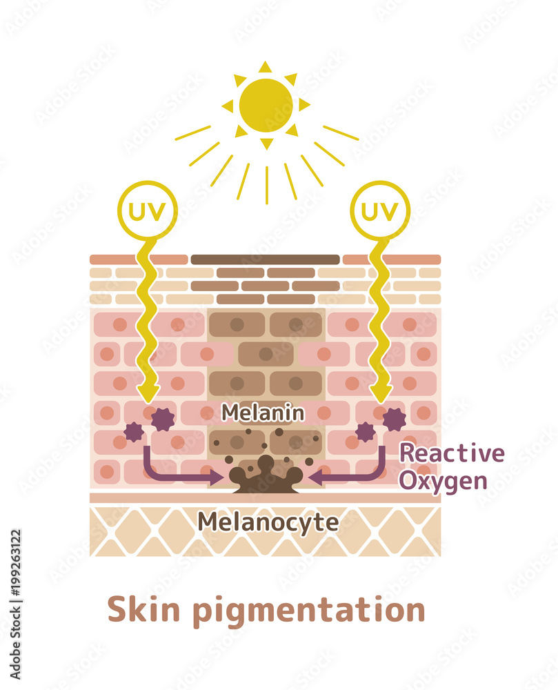 mechanism of skin pigmentation / skin spot illustration Stock Vector ...