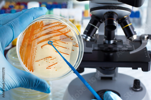 hand of technician holding plate with bacterial colonies of Streptococcus agalactiae and microscope in background / Colonies of bacteria Streptococcus agalactiae in culture medium plate  photo