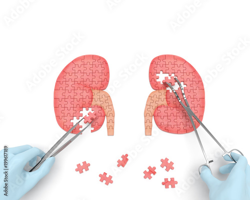 Kidneys operation puzzle concept: hands of surgeon with surgical instruments (tools) performs kidney surgery as a result of renal failure (nephrism), urinary stone disease, urosepsis, kidney cyst