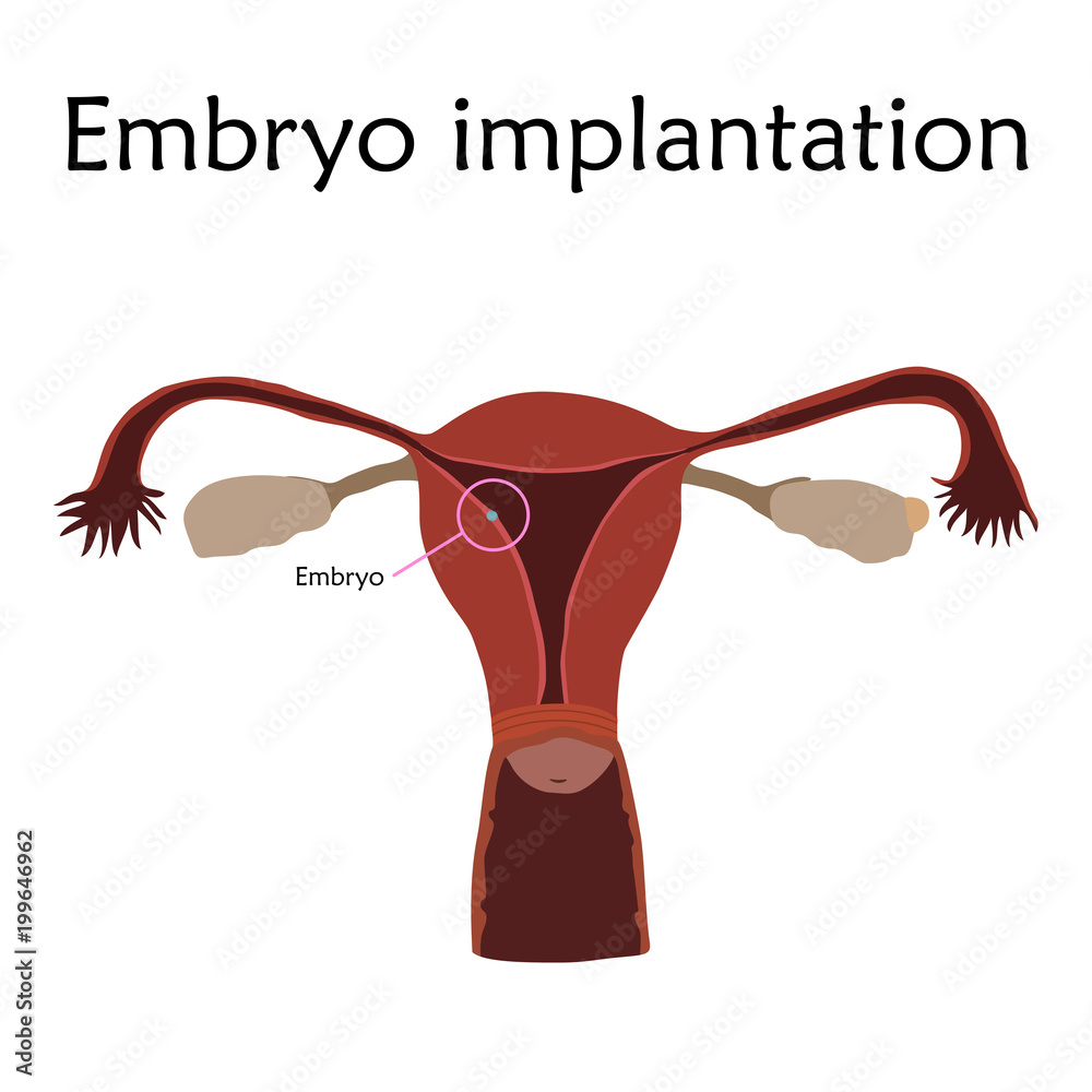 Embryo implantation. The fertilized egg, uterus, womb. Anatomy flat