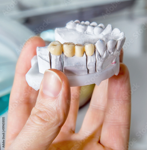Technical shots of model on a dental prothetic laboratory