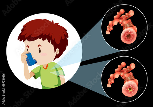 A Sick Boy on Black Background