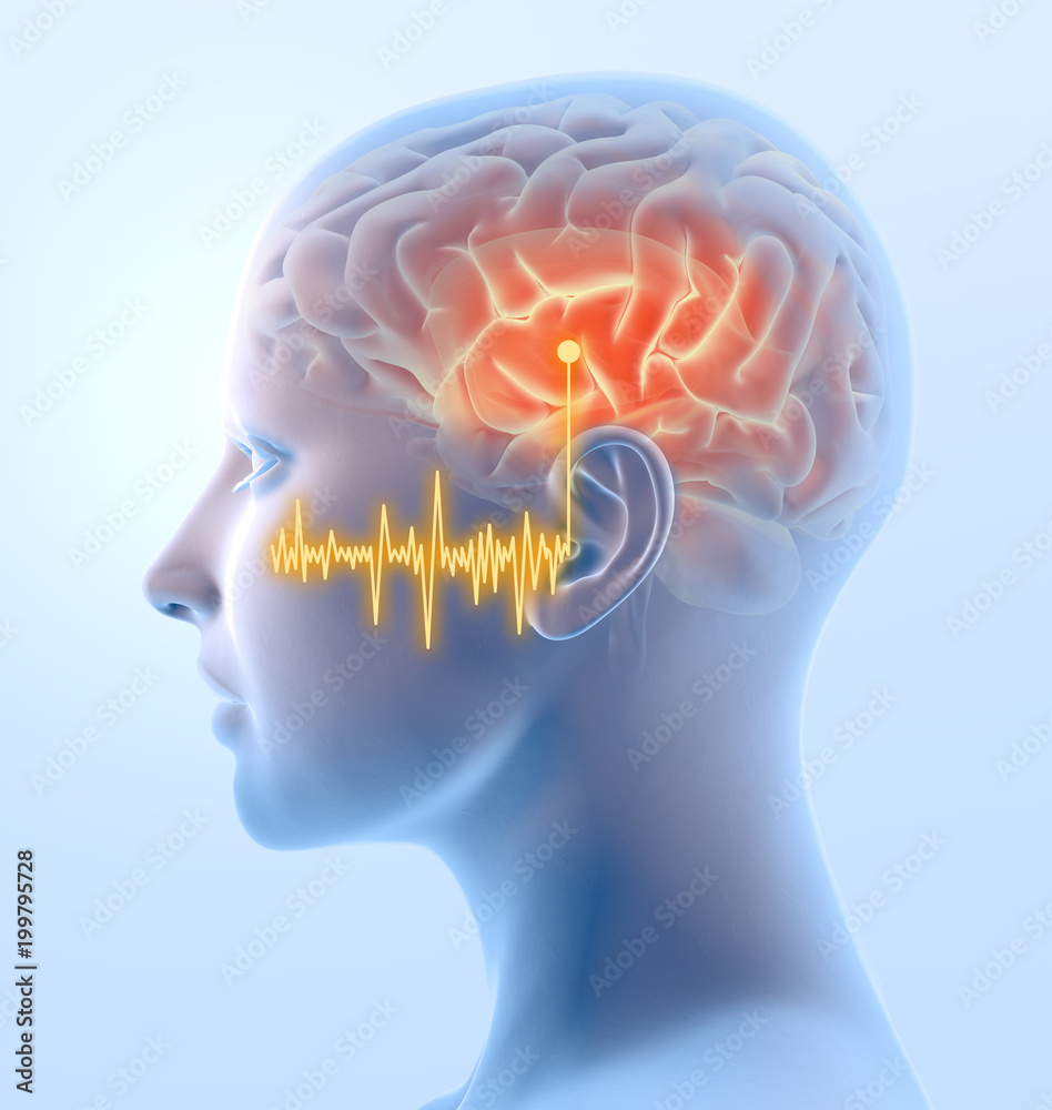 tinnitus with marked primary auditory cortex, medical illustration