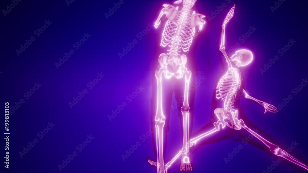basketball game players with visible bones basketball game players with visible bones