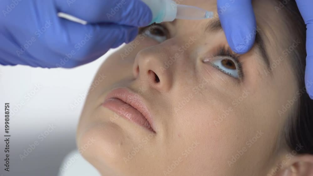 Nurse dripping medicine into patient eyes, treating dryness of eyeball, closeup Nurse dripping medicine into patient eyes, treating dryness of eyeball, closeup