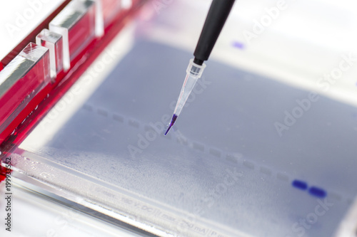 Agarose gel electrophoresis is a method of gel electrophoresis used in biochemistry, molecular biology, genetics, and clinical chemistry in lab.
