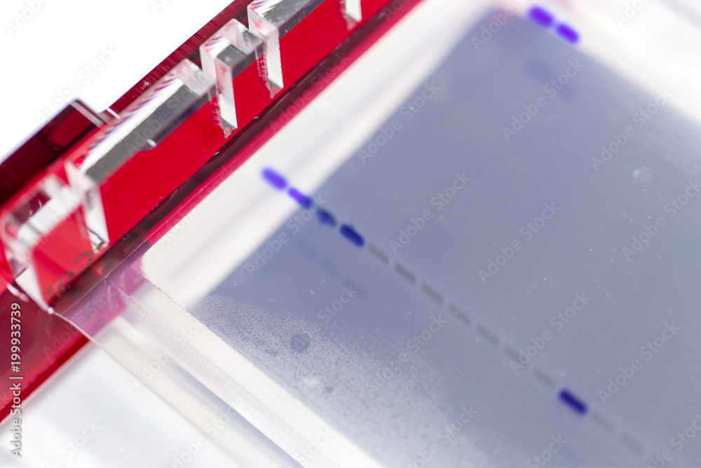 Agarose gel electrophoresis is a method of gel electrophoresis used in
