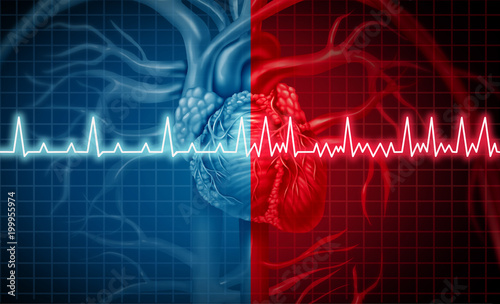 Atrial Fibrillation