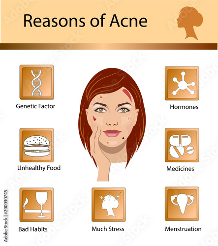Acne reasons. Skin problems and diseases beauty infographics. Vector illustration.