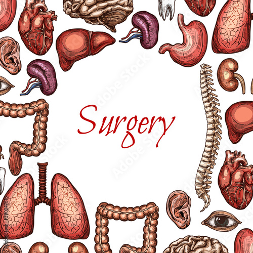 Surgery poster with human organ, body parts sketch