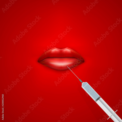 Concept of injections in lips for beauty. Red Lips and syringes. Vector illustration.