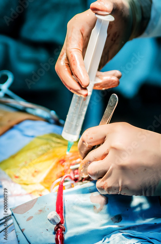The surgeon pours saline into the ventricles of the heart to check the competence of the valves.