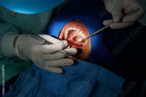 Dentist examining a patient's teeth in the clinic. Dental cure. Tooth cleaning and  tooth filling. Young female patient visiting dentist office.