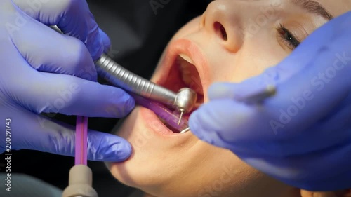 Male dentist treating teeth to young woman patient in clinic.