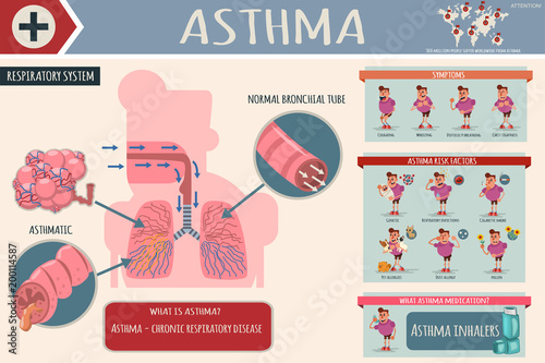 Asthma symptoms, risk factors and medications. Medical cartoon infographics of the human respiratory system with healthy and sick lungs. Vector illustration of the character of a man with a disease.