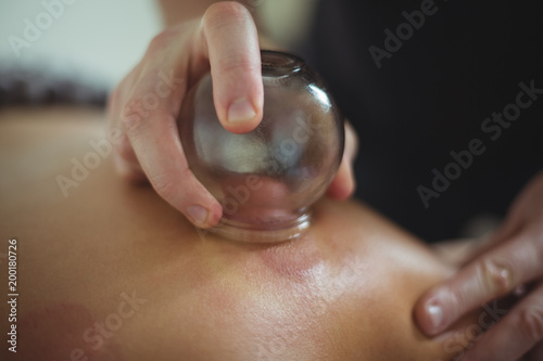 Close-up of therapist giving cupping therapy to man