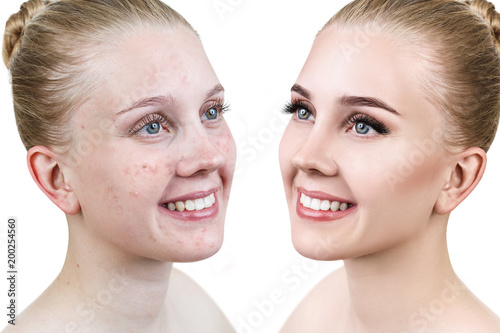 Young woman before and after retouch.