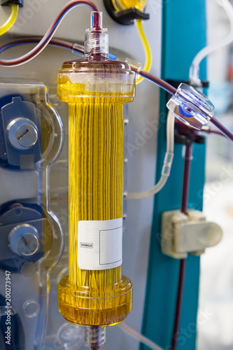 Plasmafiltration (blood purification procedure)