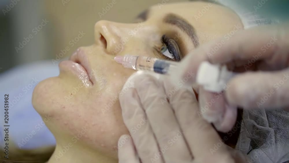 aesthetician is introducing filler to rejuvenate and fill wrinkles in nasolabial folds of adult client woman