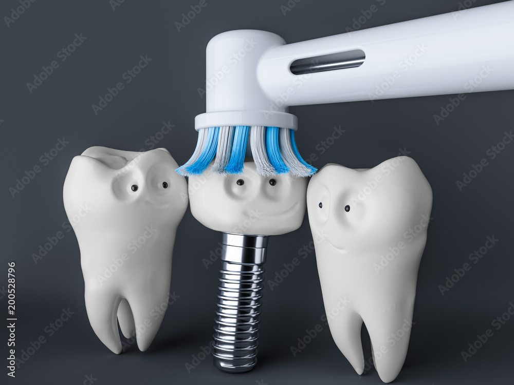 Tooth human cartoon implant- 3D Rendering Stock Illustration | Adobe Stock