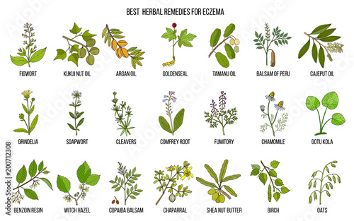 Best medicinal herbs for eczema. photo
