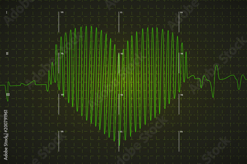 Human electrocardiogram graph in heart shape, bright green graph on dark background with marks