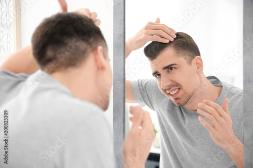 Young man with hair loss problem looking in mirror indoors