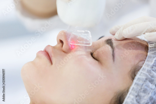 close up professional beautician making facial peeling on a nose. Laser face peeling.