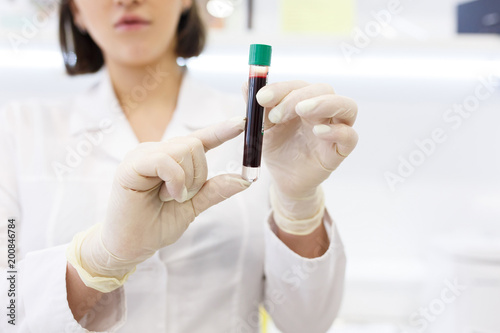 close up the uncertain doctor holds in hand test tube with blood