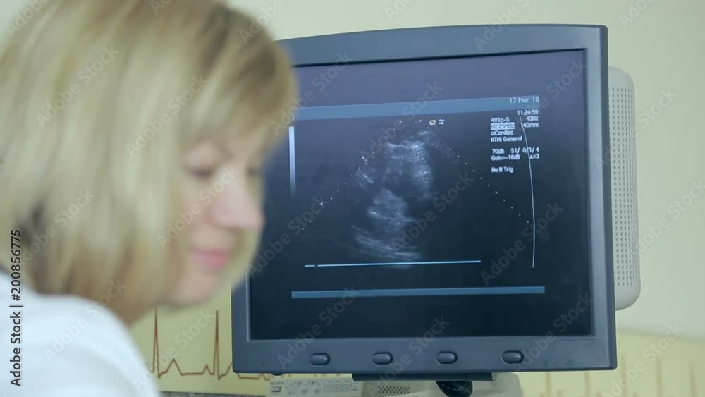 Doctor examines a patient's heart with ultrasound. Diagnostics and Ultrasound examination of the patient Doctor examines a patient's heart with ultrasound. Diagnostics and Ultrasound examination of the patient