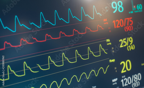 Monitor Heart Rate Beat