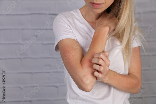 Woman Scratching an itch . Sensitive Skin, Food allergy symptoms, Irritation photo