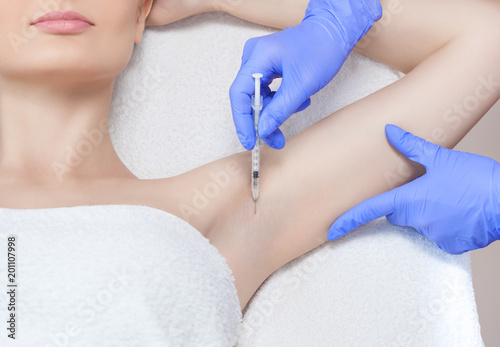 The doctor makes intramuscular injections of botulinum toxin in the underarm area against hyperhidrosis.