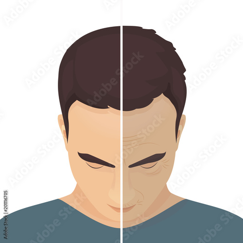 Close up vector portrait of a man before and after cosmetic procedure. Beauty facial injections for men. Anti-ageing therapy for facelift and wrinkles. Male rejuvenation treatment infographics. 