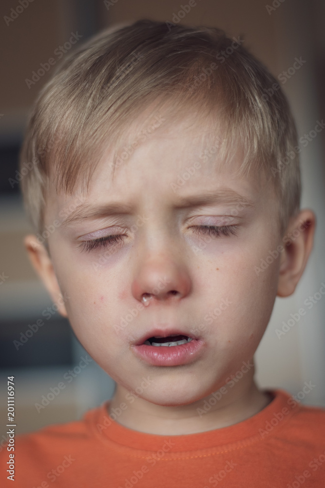 Five years old boy with allergy runny nose and closed eyes. Five years old boy with allergy runny nose and closed eyes.