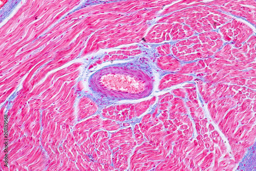 Histology of human cardiac muscle under microscope view for education.