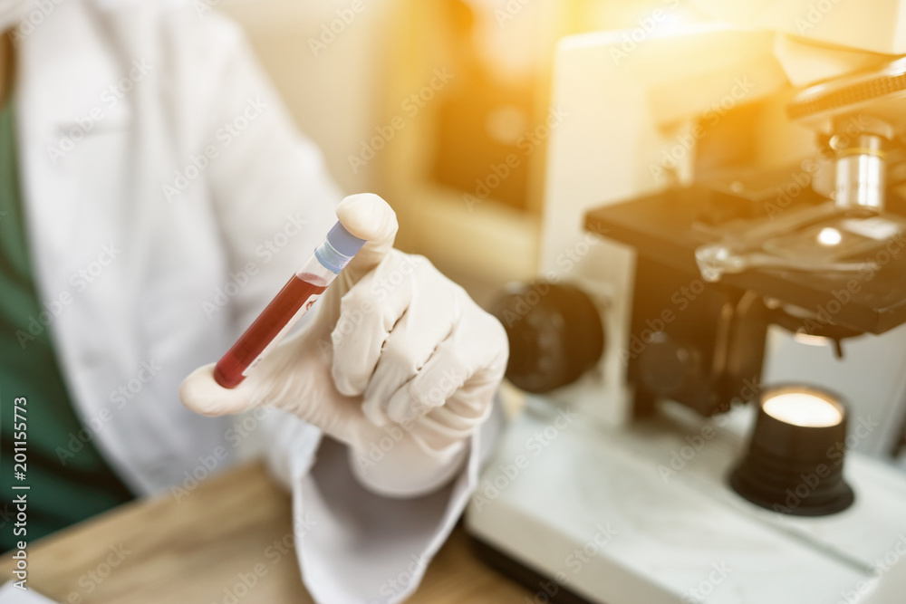 hand of a lab technician or medical doctor holding blood tube test and background a rack of color tubes  and microscope with blood samples other patients in laboratory - obrazy, fototapety, plakaty 