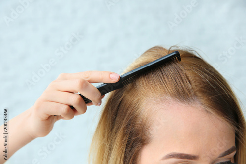 Young woman with hair loss problem, closeup