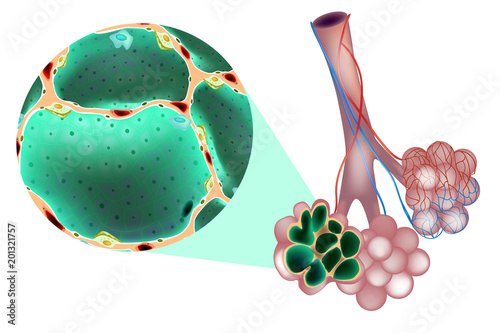 Pulmonary Alveolus air sacs) in the lung.  Main constituents of alveolus, and the interalveolar wall. Histological structure Alveolus