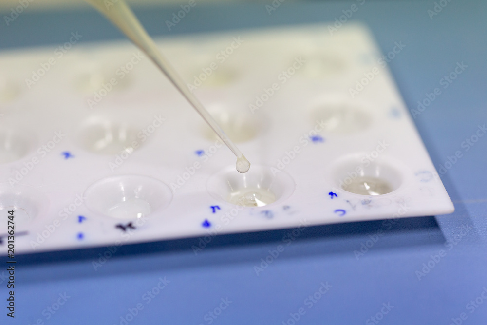 Germ, disease test of milk in laboratory Germ, disease test of milk in laboratory