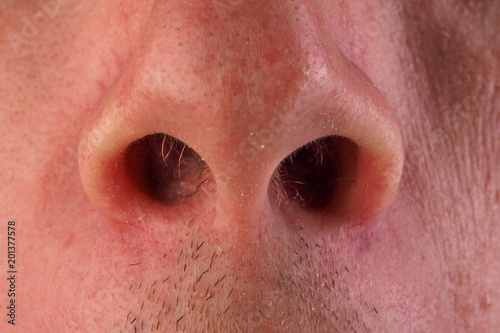 Front view of man's nose and upper lip with the mouth just visible. An image of a nose hair.
