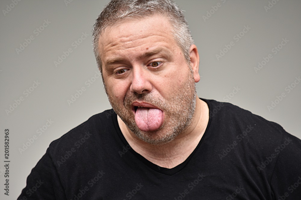 Obraz premium Unshaven Caucasian Male Poor Health